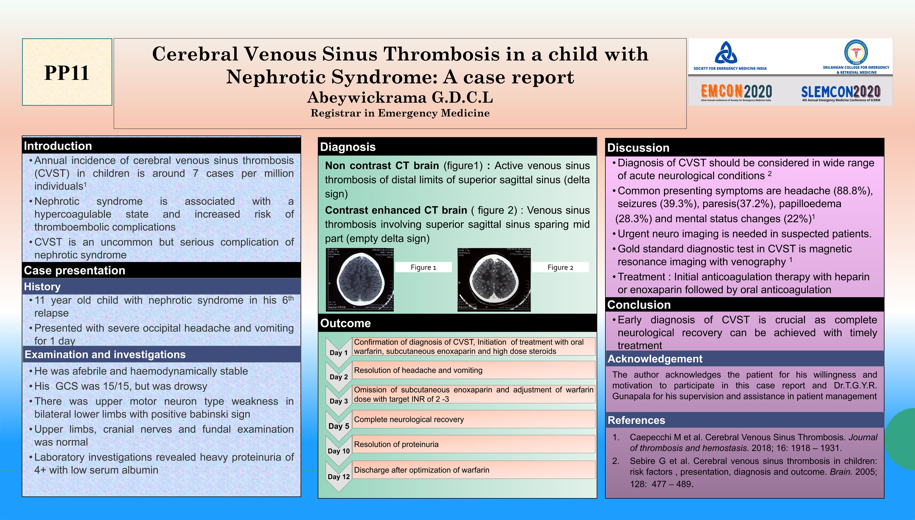 PP11 – Cerebral Venous Sinus Thrombosis in a child with Nephrotic Syndrome: A case report