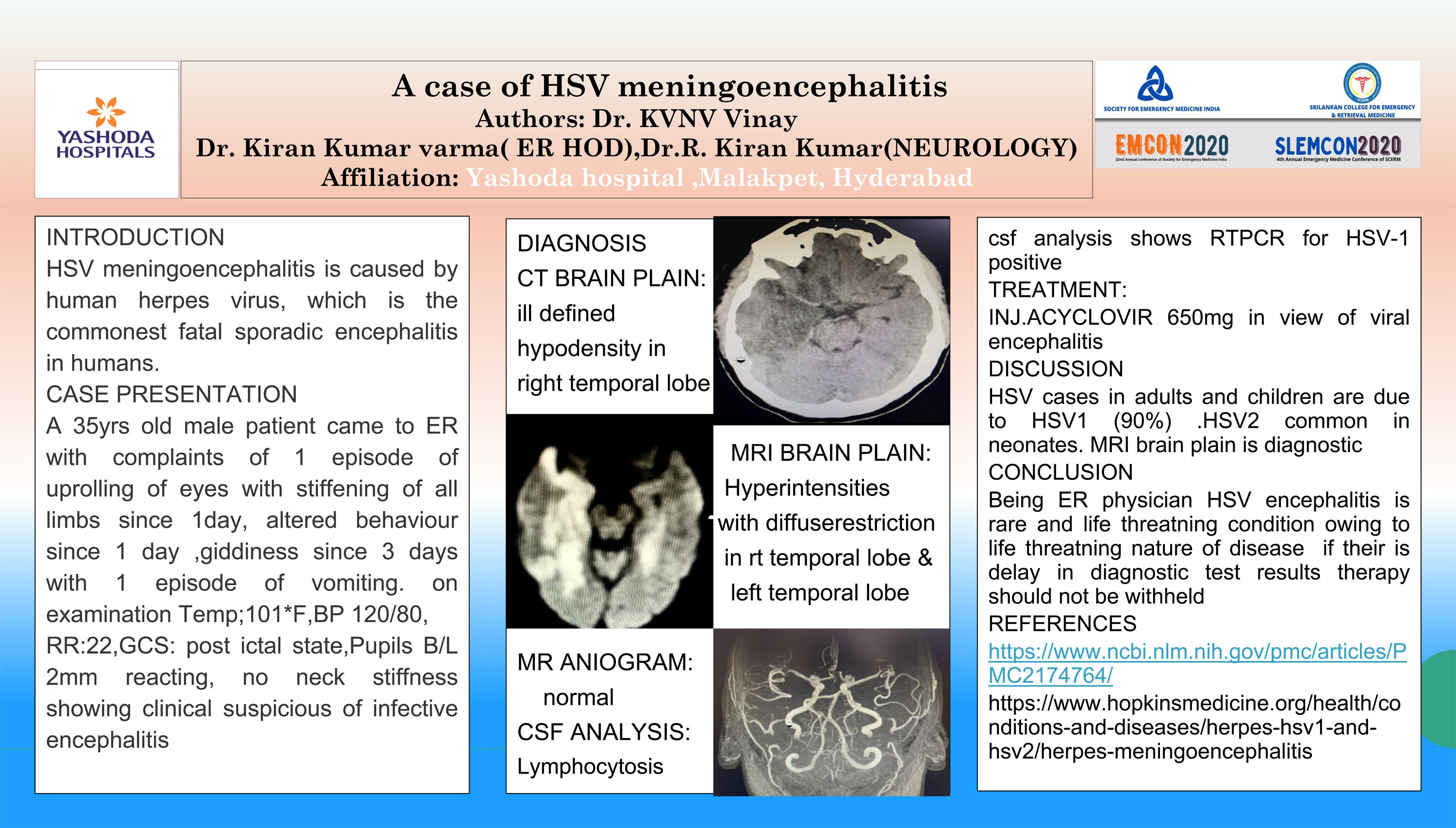PP13 – A case of HSV meningoencephalitis