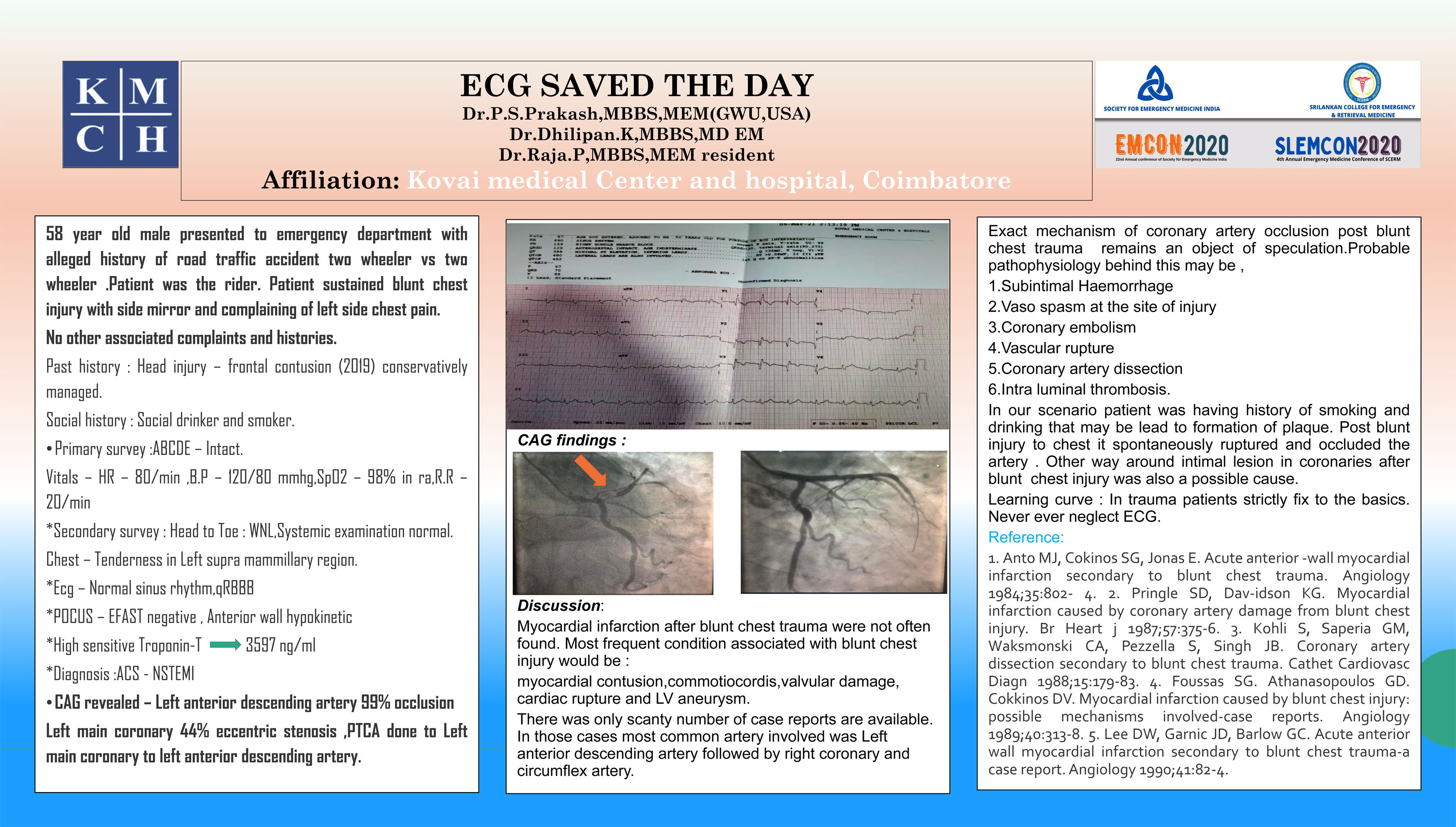 PP17 – ECG SAVED THE DAY