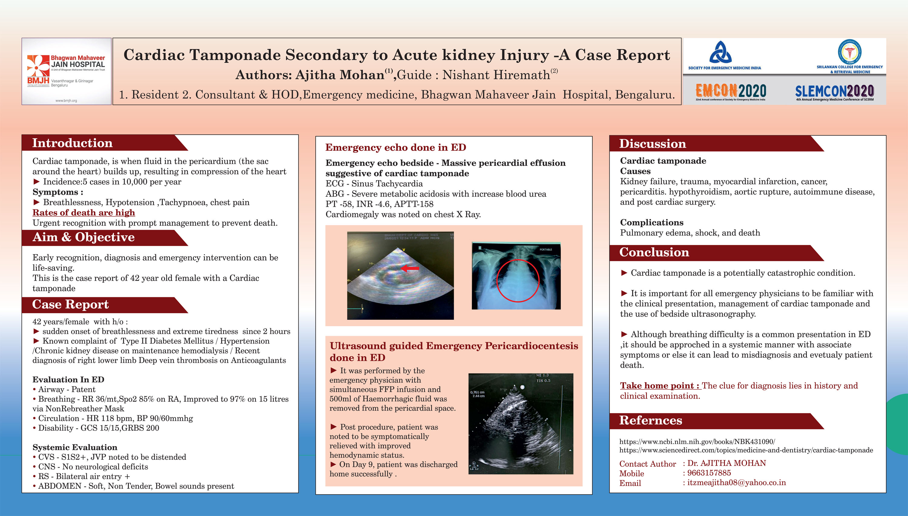 PP22 – Cardiac Tamponade Secondary to Acute kidney Injury -A Case Report